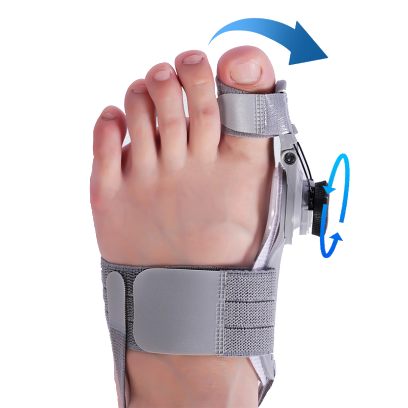 Bunion Fix - Natural At-Home Bunion Relief