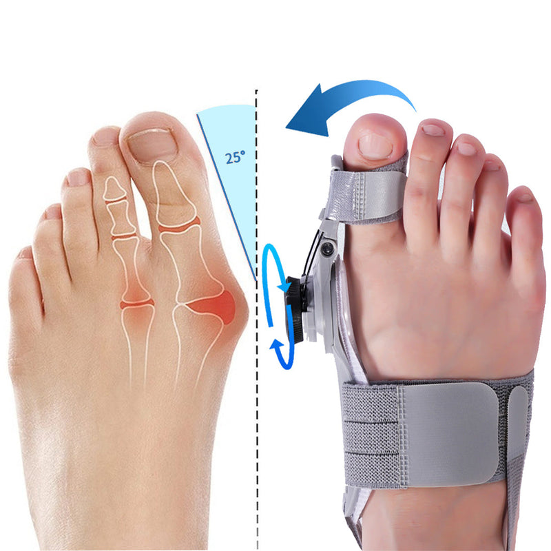 Bunion Fix - Natural At-Home Bunion Relief